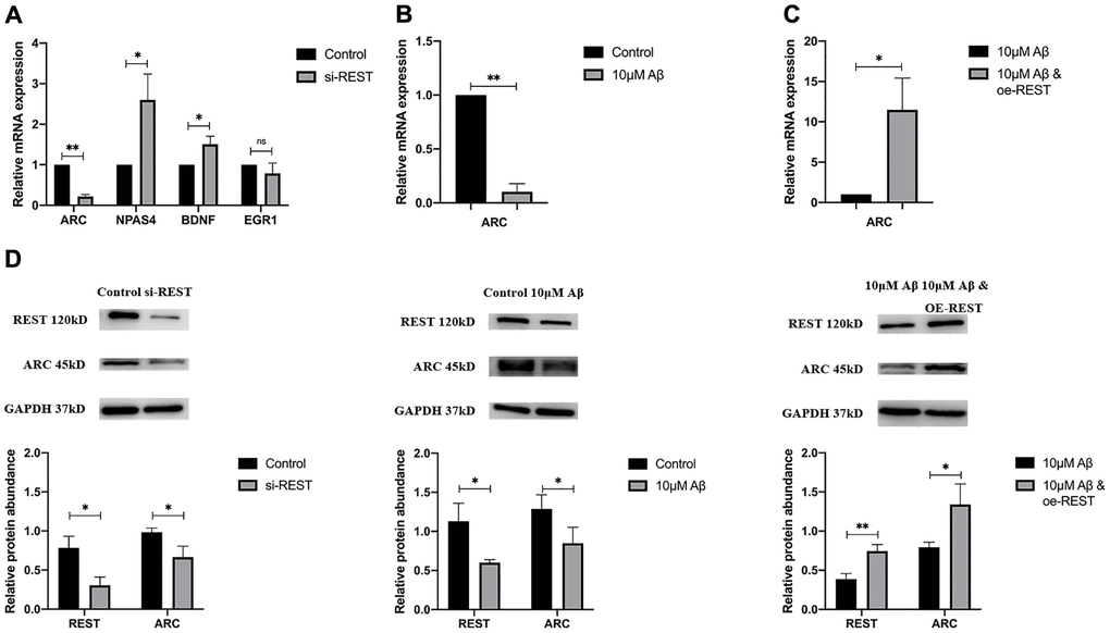 Effects of REST on IEGs. (A) REST knockdown declined ARC expression, while increased NPAS4 and BDNF expression in SH-SY5Y cells. n = 3. (B) 10 μM Aβ decreased ARC mRNA expression. n = 3. (C) Over-expression of REST significantly increased ARC mRNA expression, which was decreased by 10 μM Aβ. n = 3. (D) The ARC protein expression showed a similar trend to its mRNA expression. n = 3. Independent experiments were performed three times. Data are expressed as mean ± SEM. *p **p ***p 