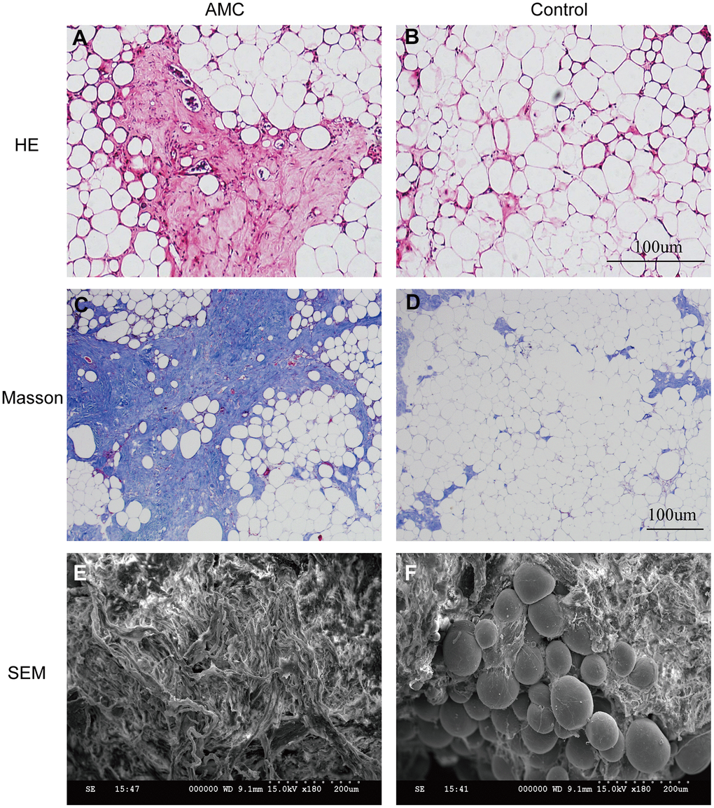 Histological structure analysis of AMC and Coleman fat. (A, B) Hematoxylin/eosin staining of AMC and Coleman fat (control) before grafting. (C, D) Masson’s trichrome staining of AMC and Coleman fat (control) before grafting. (E, F) Microstructure of AMC and Coleman fat (control) before grafting, as determined by electron microscopy.