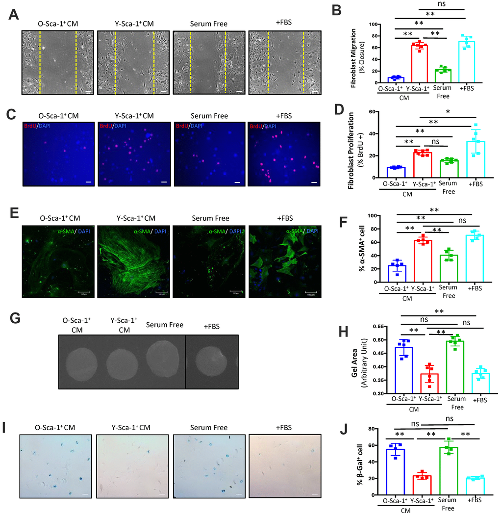 Conditioned media from Y-Sca-1+ BMCs improves functional and age-related deficits in old cardiac fibroblasts. (A) Representative images from scratch wound assay of old fibroblasts, treated with conditioned media (CM), from Y-Sca-1+ and O-Sca-1+ bone marrow cells (BMCs) for 48 hours. Dashed yellow line indicates the wound edge at 0 hours. After 48 hours, the closing distances were measured (B) (n=6). (C) Representative images from proliferation assay, after old fibroblasts were treated with CM from Y-Sca-1+ and O-Sca-1+ BMCs for 24 hours. BrdU is stained in red, and nuclei stained in blue. (D) Percentage of BrdU+ cells, normalized to total cell number. (E) Representative images of senescence assay (β-galactosidase+), after old fibroblasts were treated with CM from Y-Sca-1+ and O-Sca-1+ BMCs for 48 hours. (F) Percentage of SA-β-gal+ cells, normalized to total cell number (n=4). (G) Representative images of gels from gel contraction assay, after old fibroblasts were treated with CM from Y-Sca-1+ and O-Sca-1+ BMCs for 48 hours. (H) Gel area was measured using ImageJ (n=6). (I) Immunofluorescent staining for α-SMA was performed on old cardiac fibroblasts, after treatment with CM from Y-Sca-1+ and O-Sca-1+ BMCs for 48 hours. α-SMA is stained in green, and nuclei in blue. (J) Percentage of α-SMA+ cells, relative to total cell number (n=5). Scale bars represent 100 μm, unless otherwise stated. Data analysis was by one-way ANOVA. n=5-6; *p≤0.05, **p≤0.01; ns: not statistically significant.