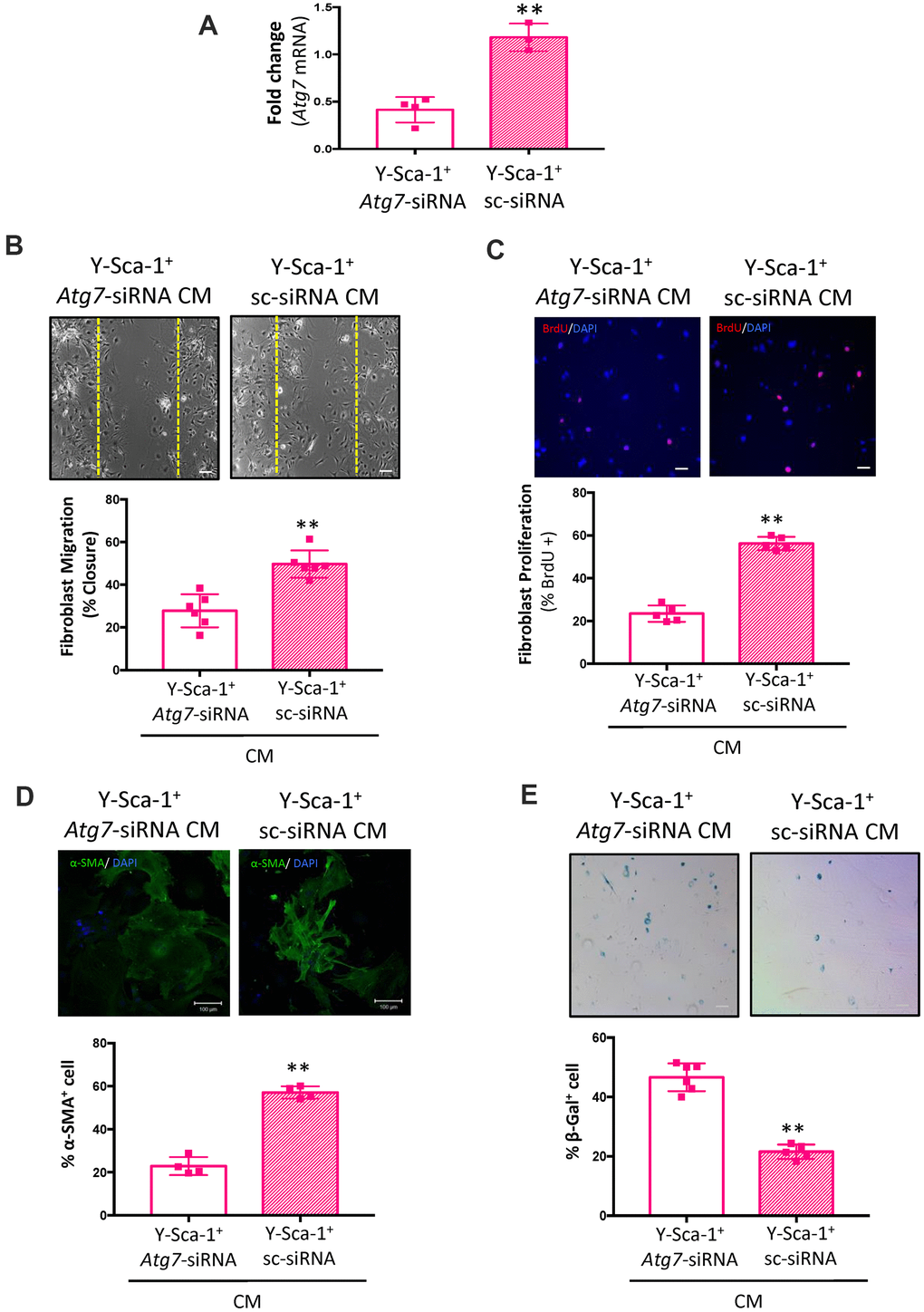 Atg7 knockdown in Y-Sca-1+ BMCs blocks paracrine stimulation of old cardiac fibroblasts. (A) Atg7 expression was measured in Y-Sca-1+ bone marrow cells (BMCs), treated with Atg7-siRNA or sc-siRNA, by RT-qPCR. n=3-4. (B–E) Quantification and representative images from (B) scratch wound assay, (C) proliferation assay, (D) stress fiber formation or (E) β-galactosidase staining of old cardiac fibroblasts, treated with Y-Sca-1+Atg7-siRNA CM or Y-Sca-1+ sc-siRNA CM for 24-48 hours. Dashed yellow line in (B) indicates the wound edge at 0 hours. Scale bar represents 100 μm. Data analysis was carried out by t-test. Data presented as mean ± SEM; n=4-6; **p≤0.01.