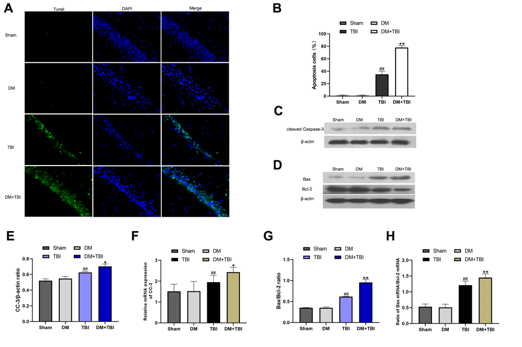 HG exacerbated neuronal apoptosis after TBI. Apoptosis was assessed using DAPI and TUNEL staining 48 h after TBI (scale bar, 50 μm). (A) Representative confocal images of hippocampal tissues stained with TUNEL (green) and DAPI (blue). (B) Bar graph of the proportion of apoptotic cells. Western blot analysis of (C) CC-3 and (D) Bax/Bcl-2 protein levels in the hippocampus 48 h after TBI or sham surgery. Bar graphs illustrate densitometric analyses of the Western blot protein bands for (E) CC-3 and (G) Bax/Bcl-2, each normalized to β-actin. Bar graphs illustrate quantitative analyses of (F) CC-3 and (H) Bax/Bcl-2 mRNA levels, each normalized to β-actin. All data are presented as the mean ± standard error (n = 5 per group). Statistical significance was determined using one-way ANOVA followed by post-hoc Bonferroni correction. #P ##P *P **P 