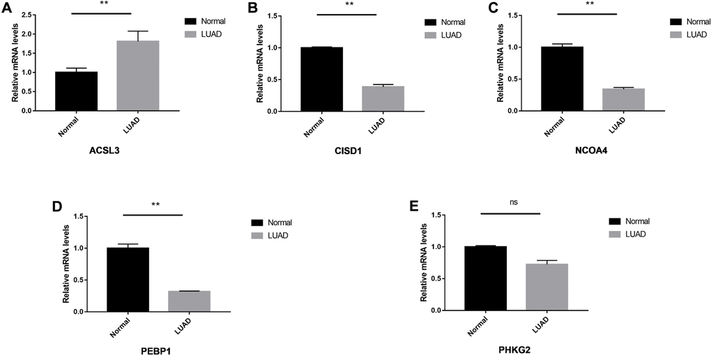 The relative expression levels of the five genes in normal and LUAD tissues. The ACSL3 (A) was up-regulated significantly and CISD1 (B), NCOA4 (C) and PEBP1 (D) were down-regulated in the LUAD tissues. No significant differences were observed in the PHKG2 (E). *P **P 