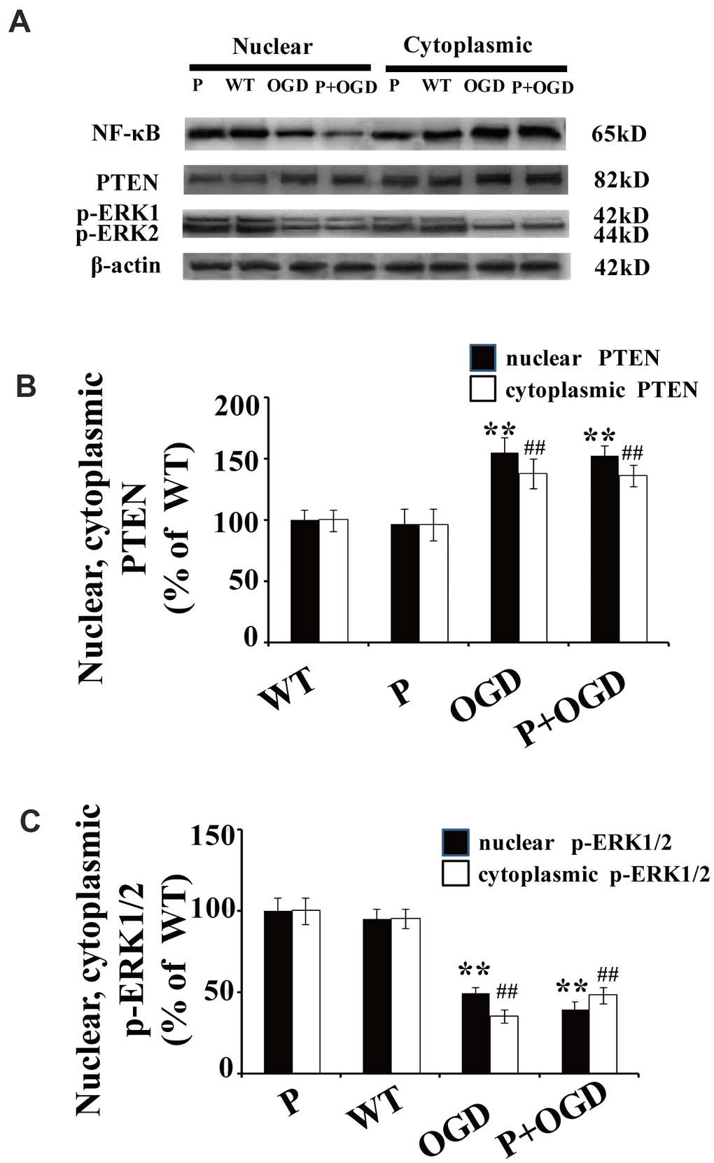 PTEN nuclear translocation is an essential step in NF-κB activation. (A) The expression of NF-κB and p-REK1/2 after PDTC treatment. Western blot of cytoplasmic and nuclear fractions shows that the nuclear translocation of NF-κB decreased in PDTC-treated neurons, while there was no obvious change in the nuclear translocation of PTEN or the expression of p-ERK1/2. (B) Quantification of nuclear and cytoplasmic PTEN expression, normalized against normal neurons. (C) Quantification of nuclear and cytoplasmic p-ERK1/2 expression, normalized against GFP-PTENWT neurons. n = 5 in each column and ** p WT neurons, K13R: GFP-PTENK13R neurons; P: PDTC.