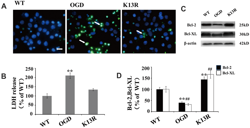 Inhibition of PTEN nuclear translocation reduces neural injury after OGD. (A) TUNEL-positive cells increased after OGD. This enhanced apoptosis was blocked in GFP-PTENK13R neurons. Scale bars = 50 μm. (B) Extracellular levels of LDH decreased in GFP-PTENK13R neurons after OGD. (C) Bcl-2 and Bcl-xL protein expression was evaluated by western blot which showed that their expression increased in GFP-PTENK13R neurons after OGD. (D) Quantification of Bcl-2 and Bcl-xL protein expression normalized against GFP-PTENWT neurons. n = 5 in each column and ** p WT neurons, K13R: GFP-PTENK13R neurons; P: PDTC.