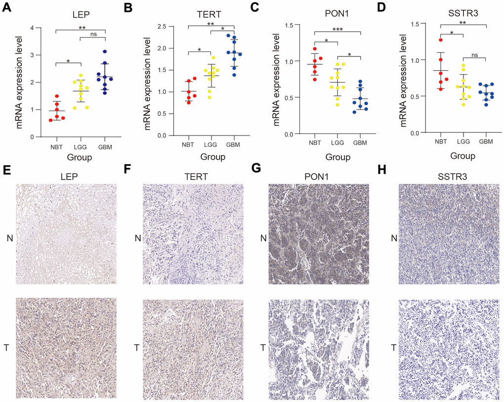 Validation of the bioinformatics results using RT-qPCR and immunohistochemistry assay. (A–D) Comparison of LEP (A), TERT (B), PON1 (C), and SSTR3 (D) mRNA expression levels in normal brain tissue (NBT), lower-grade glioma (LGG), and glioblastoma (GBM) tissues by RT-qPCR assay. (E–H) Comparison of the protein expression of LEP (E), TERT (F), PON1(G) and SSTR3 (H) in NBT and glioma tissue by immunohistochemistry assay. Non-significant (ns) P > 0.05, * P P P 