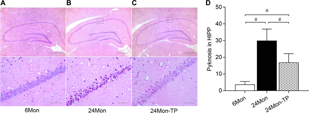 TP supplementation preserves neuronal integrity in the HIPP of aged male rats. (A–C) Representative photomicrographs of hippocampal sections stained with HE. Scale bars = 200 μm (upper panel), 20 μm (lower panel). (D) Quantification of karyopyknosis in the CA1 pyramidal stratum of the HIPP. Data are expressed as the mean ± S.D. (n = 6/group). #P U test, Bonferroni correction).