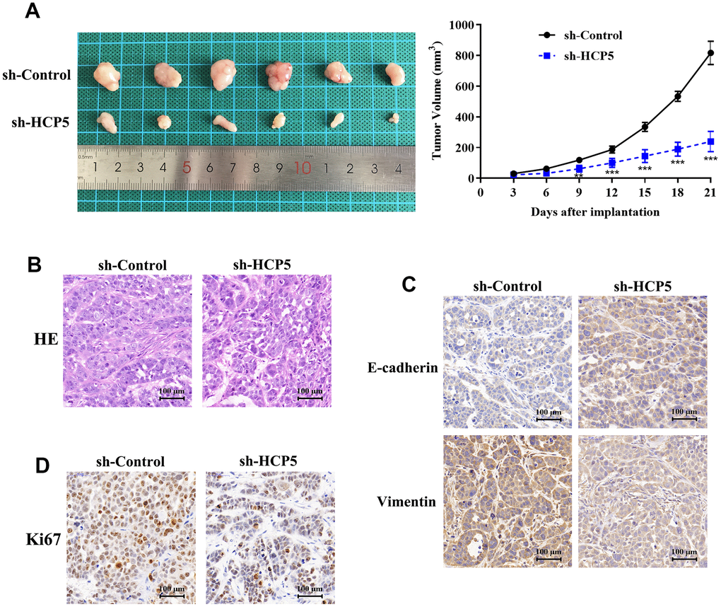 LncRNA HCP5 promotes the growth and migration of HCC in vivo. (A) Tumor growth curve suggesting that the knockdown of HCP5 results in lower tumor growth in vivo (**pB) Results of hematoxylin and eosin (HE) staining. (C) Immunohistochemistry demonstrating the expression of E-cadherin and vimentin between tissues transfected with sh-control and sh-HCP5. (D) Immunohistochemistry illustrating that the knockdown of HCP5 results in lower a proliferation rate in HCC tissue when compared to the control group.