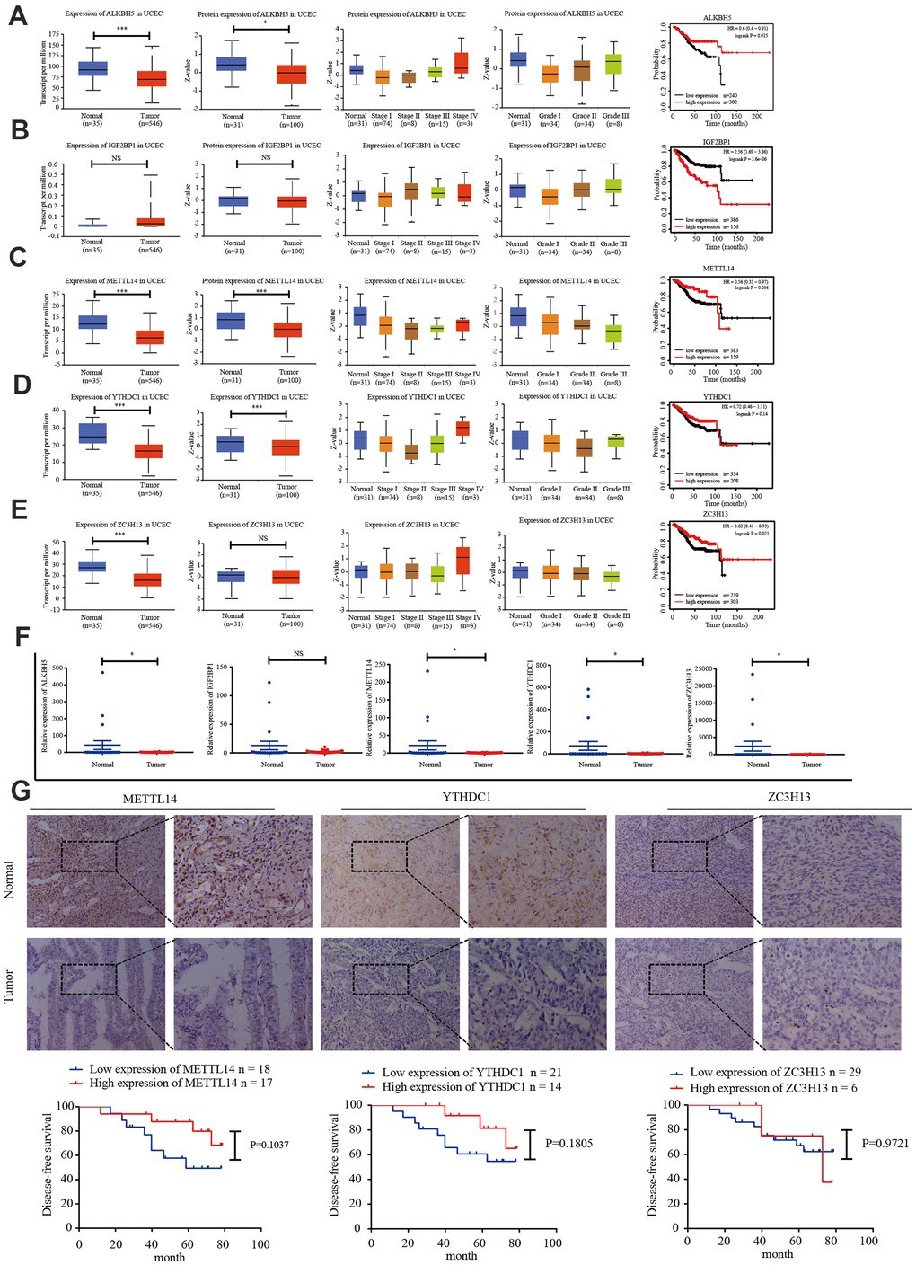 Candidate m6A regulator protein and mRNA expression. (A–E) TCGA and UALCAN website analysis of IGF2BP1, ZC3H13, METTL14, ALKBH5, and YTHDC1 mRNA expression in 35 normal and 546 EC tissues, protein expression in 31 normal and 100 EC tissues, and Kaplan-Meier survival curve of the prognostic signature based on five m6A-related genes. *P P P F) Expression of the five genes in 34 EC tissues and 20 normal tissues, as determined by qRT-PCR. (G) Protein expression of ZC3H13, METTL14, and YTHDC1 in 35 EC tissues and 20 normal tissues was determined by immunohistochemistry. DFS curves for ZC3H13, METTL14, and YTHDC1 protein expression in 35 endometrial carcinoma cases. *P P P 