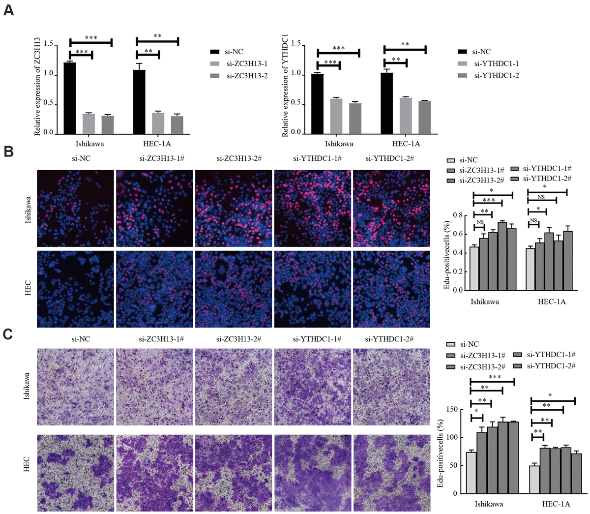 Knockdown of ZC3H13 or YTHDC1 promotes the malignant behavior of Ishikawa and HEC-1A cells. (A) qRT-PCR was used to determine transfection efficiency. (B) The effect of ZC3H13 or YTHDC1 expression on the proliferation of Ishikawa and HEC-1A cells was determined via EdU assays. (C) Transwell assays were used to determine the number of invading cells. Data are presented as the mean ± SEM (n = 3 per group), *P P P 