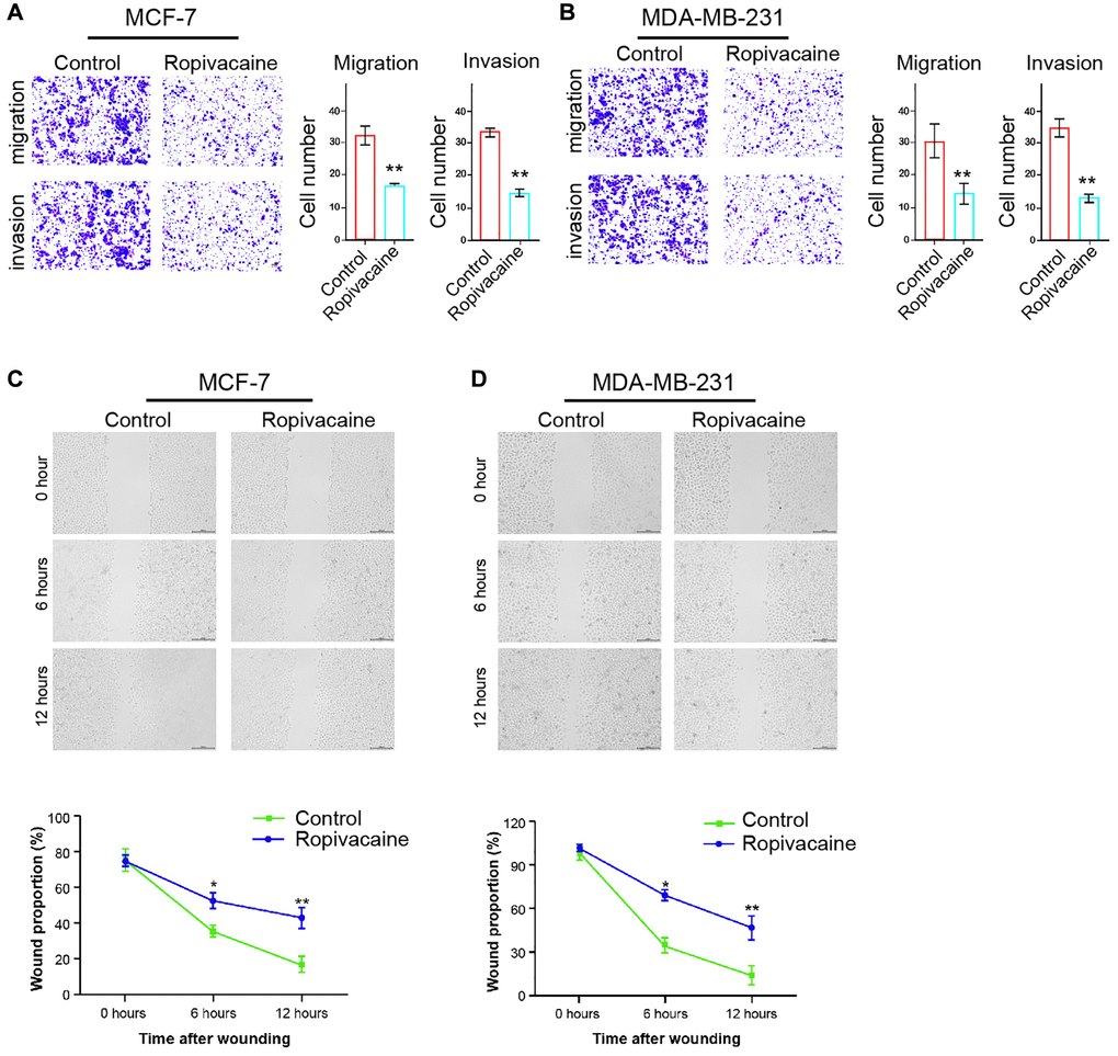 Ropivacaine decreases invasion and migration of breast cancer cells. (A–D) The MCF-7 and MDA-MB-231 cells were treated with ropivacaine (1 mmol/L) or equal volume saline. (A and B) The cell migration and invasion were examined by transwell assays in the cells. (C and D) The migration and invasion were measured by wound healing assays in the cells. The wound healing proportion was shown. N = 3, The independent experiments were repeated for three times. Data are presented as mean ± SD. Statistic significant differences were indicated: *P **P 