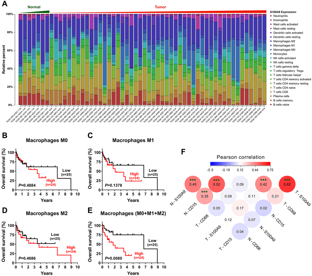 Tumor-infiltrating immune cells associated with S100A9 expression in HCC. (A) Differential infiltration of immune cells based on S100A9 expression in groups from the TCGA-LIHC cohort. The proportions of 22 immune infiltrates in tumor (n = 49) and nontumor tissue (n = 7) were estimated using the CIBERSORT algorithm. (B–E) Prognostic value of M0, M1, M2 and total (M0 + M1 + M2) macrophage densities in HCC (n = 49). (F) The densities of S100A9+ cells and CD15+ neutrophils and CD68+ macrophages were analyzed using Pearson correlation analysis (n = 382). ***P 