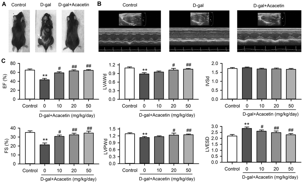 Effects of acacetin on cardiac function in a mouse aging model induced by D-galactose. (A). Back hair loss (white arrow) was observed in mice with subcutaneous injection of D-galactose (D-gal, 150 mg/kg/day), but not in D-galactose mice with oral acacetin (50 mg/kg/day). (B) Representative echocardiography images of control mouse, D-galactose mouse and D-galactose mouse with oral acacetin (50 mg/kg/day). (C) Echocardiograph parameters: left ventricular ejection fraction (EF), fractional shortening (FS), diastolic left ventricular anterior wall thickness (LVAWd), diastolic left ventricular posterior wall thickness (LVPWd), thickness of interventricular septal end diastole (IVSd), and left ventricular end-systolic diameter (LVESD) in mice without (control) or with D-galactose or D-galactose plus oral acacetin 10, 20 or 50 mg/kg/day (n = 10-12, **P #P ##P 