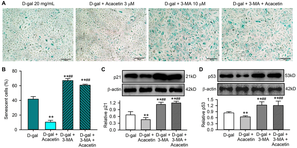 The autophagy inhibitor 3-methyladenine abolished the protective effect of acacetin against H9C2 cell senescence induced by D-galactose. (A) Representative images of SA-β-gal staining for senescent cells in H9C2 cardiac cells treated with D-galactose (D-gal) in the absence or presence of 3 μM acacetin or 10 μM 3-methyladenine (3-MA) with or without 3 μM acacetin for 72 h. (B) Percentage of senescent cells in cells treated as in (A). (C) Western blots and relative level of p21 protein in cells treated as in (A). (D) Western blots and relative level of p53 protein in cells treated as in (A). (n = 4, **P ##P 