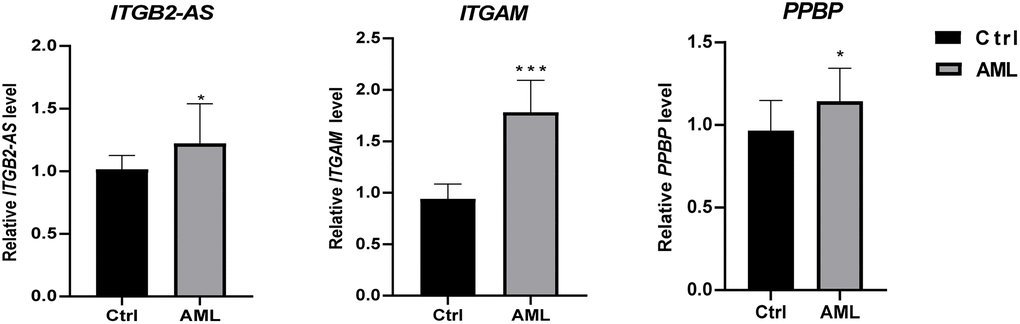 The differential expression of critical genes in clinical samples between AML and healthy individuals. The result of clinical validation showed that ITGB2-AS, ITGAM, and PPBP are significantly higher in the initial diagnosed AML. ***P *P 