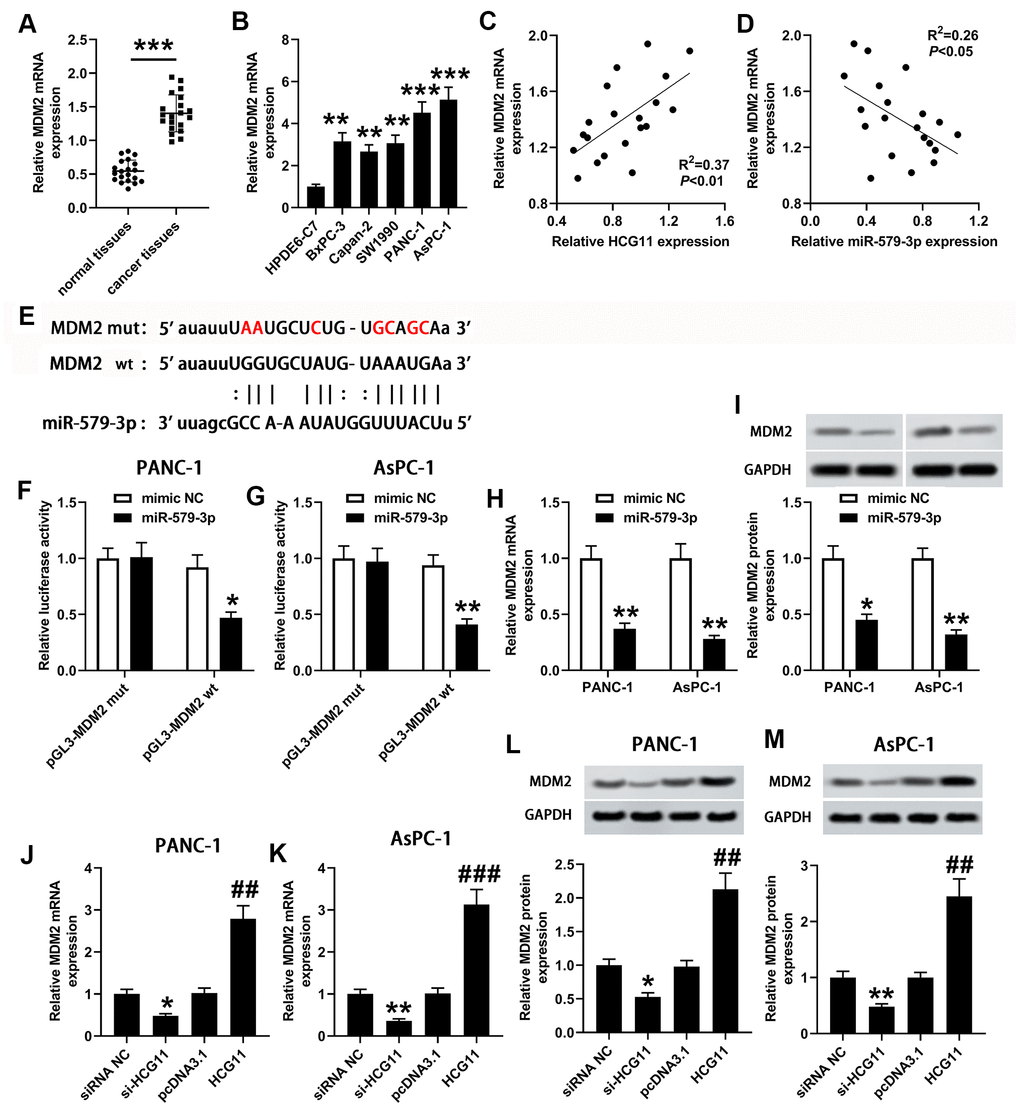 miR-579-3p directly targeted MDM2 to suppress MDM2 expression. (A) qPCR assay was used to examine MDM2 expression in 20 pairs of pancreatic carcinoma tissues and corresponding normal tissues. ***pB) MDM2 expression in pancreatic carcinoma cell lines (BxPC-3, Capan-2, SW1990, PANC-1 and AsPC-1) was also detected by qPCR assay. **p***pC, D) Analysis from qPCR revealed that MDM2 expression was positively related to HCG11 expression, and negatively associated with miR-579-3p expression. (E) The binding sites between miR-579-3p and MDM2 were exhibited. (F, G) The luciferase activity in PANC-1 and AsPC-1 cells was measured by the luciferase reporter assay after transfected with miR-579-3p mimic/NC and MDM2-mut/wt vector. (H, I) MDM2 mRNA and protein expression levels in pancreatic carcinoma cells were detected by qPCR and western blotting assays when treated with miR-579-3p mimic or NC. *p**pJ–M) MDM2 mRNA and protein expression levels in pancreatic carcinoma cells were detected by qPCR and western blotting assays when treated with siRNA NC, si-HCG11, pcDNA3.1, and pcDNA3.1-HCG11. *p**p##p###p