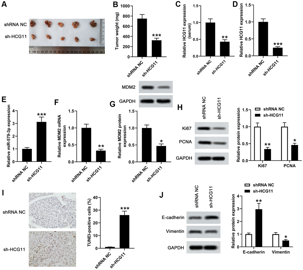 Knockdown of HCG11 inhibited the tumor growth in xenograft mouse model. (A) We examined the effect of knockdown of HCG11 on the regulation of subcutaneous transplantation mouse model of pancreatic carcinoma by using AsPC-1 cells. (B) Four weeks later, the tumor weight of sh-HCG11 group and shRNA NC group was measured. (C) qPCR assay was applied to detect HCG11 expression (serum) in sh-HCG11 group and shRNA NC group. (D) HCG11 expression (tissues) in sh-HCG11 group and shRNA NC group was also detected by qPCR assay. (E) The expression level of miR-579-3p (tissues) in sh-HCG11 group and shRNA NC group was measured by qPCR. (F, G) The mRNA and protein levels of MDM2 (tissues) in sh-HCG11 group and shRNA NC group were measured by qPCR and western blotting assays. (H) The levels of proliferation associated proteins including Ki67 and PCNA were detected by western blotting assay in sh-HCG11 group and shRNA NC group. (I) The TUNEL-positive cells in sh-HCG11 group and shRNA NC group were measured by TUNEL assay. (J) Western blotting assay was applied to detect E-cadherin and Vimentin expression in sh-HCG11 group and shRNA NC group. *p**p**p