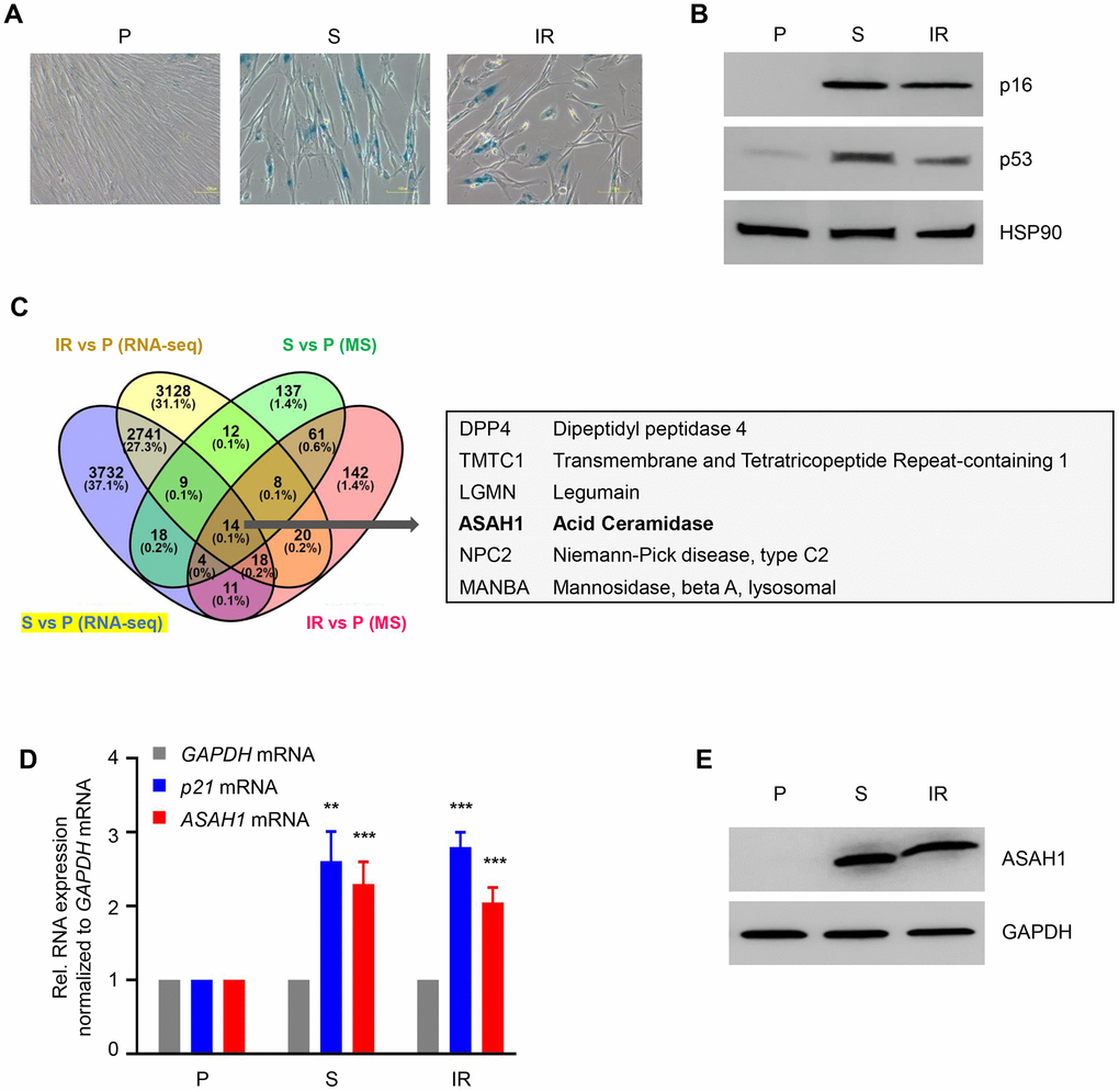 ASAH1 is highly expressed in senescent cells. (A) Senescence-associated β-galactosidase (SA-βGal) staining of WI-38 fibroblasts that were proliferating (P, PDL25) or were rendered senescent (S, PDL52) by extended culture or by exposure to ionizing radiation (IR, 10 Gy) and assayed 10 days later. (B) Western blot analysis of senescence marker proteins p16 and p53 in cells prepared as described in (A). The levels of loading control HSP90 were also assessed. (C) Left, Venn diagram showing commonly upregulated mRNAs (RNA-sequencing data) and proteins obtained by mass spec (MS) analysis (full list provided as Supplementary Table 1) in replicative senescence (S) and IR-induced senescence relative to proliferating (P) fibroblasts. Right, partial list of the shared mRNAs and proteins upregulated in senescent cells. (D, E) In cells that were processed as in (A), the steady-state levels of p21 and ASAH1 mRNAs were quantified by RT-qPCR analysis (mRNA levels were normalized to GAPDH mRNA levels), and the levels of ASAH1 were assessed by Western blot analysis (loading control protein GAPDH was included). Data in (D) are the means ±S.D. of three biological replicates; data in (A, B, E) are representative of three biological replicates. RNA-seq is provided in GSE85771.