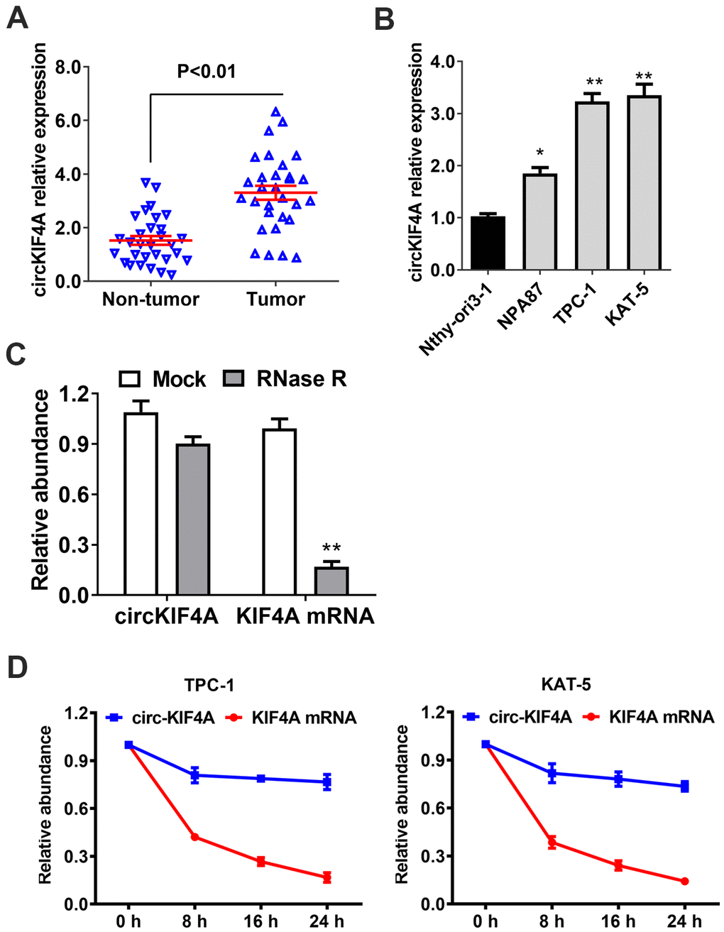 circKIF4A is upregulated in papillary thyroid cancer with circular characteristics. (A) circKIF4A expression in adjacent normal tissues and papillary thyroid cancer. (B) The relative expression of circKIF4A in cell lines. (C) RNase R assay examined the circular structure of circKIF4A in TPC-1 cell line. (D) Circular transcripts of KIF4A (circKIF4A) was more stable than its linear mRNA transcripts determined by actinomycin D treated assay.