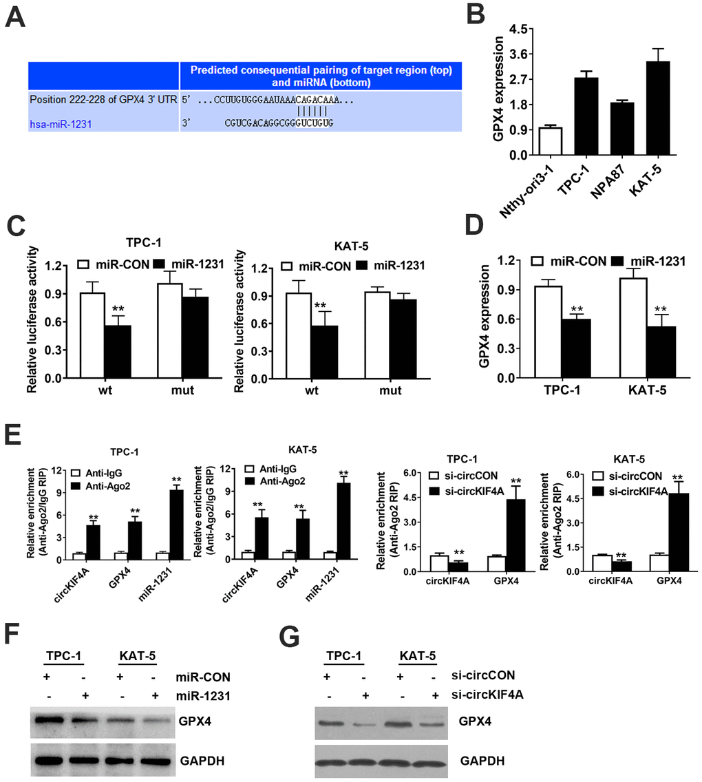 CircKIF4A promotes papillary thyroid cancer progression through circKIF4A-miR-1231-GPX4 axis. (A) Predicted interacting site of miR-1231 within the 3’-UTR of GPX4. (B) GPX4 expression in papillary thyroid cell lines. (C) Dual luciferase reporter assay of TPC-1 and KAT-5 cells. (D) Expression of GPX4 was reduced after overexpression of miR-1231. (E) Enrichment of circKIF4A, GPX4 and miR-1231 on AGO2 RNA binding protein assessed by RIP assay. (F) Overexpression of miR-1231 resulted in the reduction of GPX4 protein expression. (G) Knockdown of circKIF4A reduced the protein expression of GPX4.