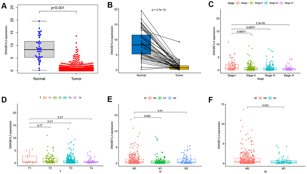 Expression of deoxyribonuclease 1-like 3 (DNASE1L3) in colon cancer and its correlation with clinicopathology. (A) The expression of DNASE1L3 in colon cancer and normal samples (pB) Expression analysis of DNASE1L3 in colon cancer and paired normal samples (p=2.7e-12, Wilcoxon rank sum test). (C–F) The association between DNASE1L3 and clinicopathology (Kruskal–Wallis rank sum test or Wilcoxon rank sum test, statistical significance at p