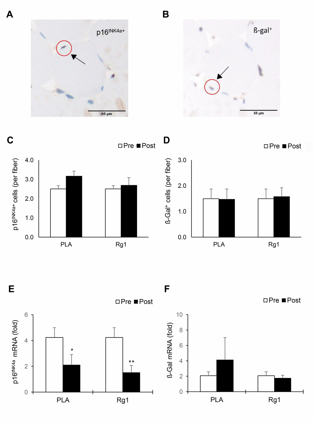 Biomarkers of cellular senescence in human skeletal muscle 24 h after squat exercise. The p16INK4a+ cells (A) and ß-Gal+ cells (B) are indicated by brown precipitates surrounding myofibers in the immunohistochemical stains of muscle cross-sections. No significant changes in quantity of p16INK4a+ cells (C) and ß-Gal+ cells (D) Were observed post exercise during PLA- and Rg1-supplemented trials. Squat exercise decreased p16INK4a mRNA (E) While no effect on ß-Gal mRNA (F) in vastus lateralis muscle of young men with training experience. *denotes significant difference against Pre, p **denotes significant difference against Pre, p +: ß-Galactosidase; PLA: Placebo; Rg1: Ginsenoside Rg1.