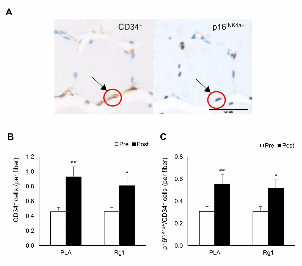 Endothelial progenitor cell expansion (CD34+ cells) in human skeletal muscle 24 h after squat exercise. The CD34+ cells and p16INK4a+ cells (B) are indicated by brown precipitates surrounding myofibers in immunohistochemical stains of muscle cross-section. (A) CD34+ cells were nearly doubled post exercise (C). Approximately 65% of CD34+ cells were colocalized with p16INK4a+ cells. This ratio was not much affected after exercise (60%) in the trained men. *denotes significant difference against Pre, p **denotes significant difference against Pre, p 