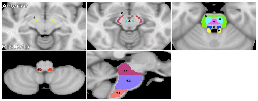 Visualization of the brainstem WM and GM ROIs studied. (1) Subthalamic nucleus, (2) Cerebral peduncle, (3) Substantia nigra, (4) Red nucleus, (5) Middle cerebellar peduncle, (6) Corticospinal tract, (7) Pontine tract, (8) Lemniscus tract, (9) Superior cerebellar peduncle, (10) Inferior cerebellar peduncle, (11) Midbrain, (12) Pons, and (13) Medulla. The brainstem structural images were obtained from the standard MNI atlas. Representative slices were chosen for visualization.
