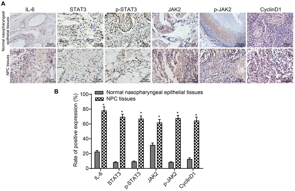 The positive rates of IL-6, STAT3, p-STAT3, JAK2, p-JAK2 and CyclinD1 were obviously higher in NPC tissues. (A) The results of immunohistochemical staining in NPC tissues and normal nasopharyngeal epithelial tissues (× 400); (B) The positive expression rates of IL-6, STAT3, p-STAT3, JAK2, p-JAK2 and CyclinD1 in NPC tissues (n = 117) and normal nasopharyngeal epithelial tissues (n = 112) (5 sections selected in each result); *p 