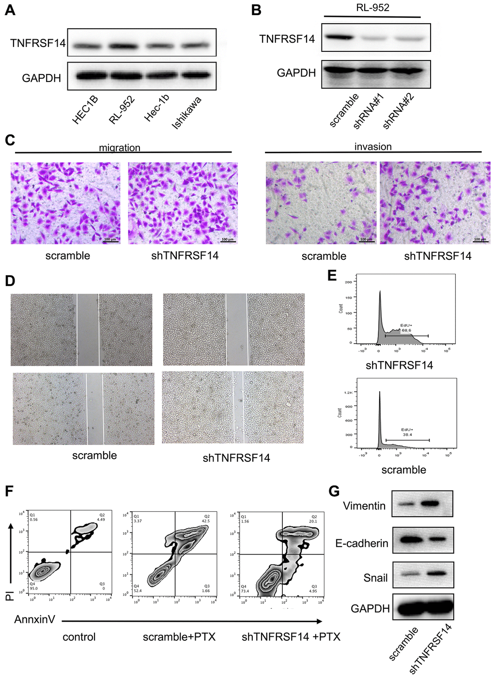 TNFRSF14 knockdown promotes EC progression by enhancing EMT. (A) Western blot analysis shows TNFRSF14 protein expression in EC cell lines (HEC1B, RL-952, Hec-1B, and Ishikawa). (B) Western blot analysis shows TNFRSF14 protein levels in control and TNFRSF14-shRNA#1- and TNFRSF14-shRNA#2-transfected RL-952 cells. (C–D) Transwell invasion assay and wound healing assay results show the invasiveness and migration ability of control and TNFRSF14-silenced RL-952 cells. (E) EdU incorporation assay results show the proliferation rates of control and TNFRSF14-silenced RL-952 cells. (F) Flow cytometry analysis shows the percentage apoptosis of 5-fluorouracil-treated control and TNFRSF14 knockdown RL-952 cells. (G) Western blot analysis shows expression levels of EMT-associated marker proteins, Vimentin and Snail, in control and TNFRSF14-silenced RL-952 cells.