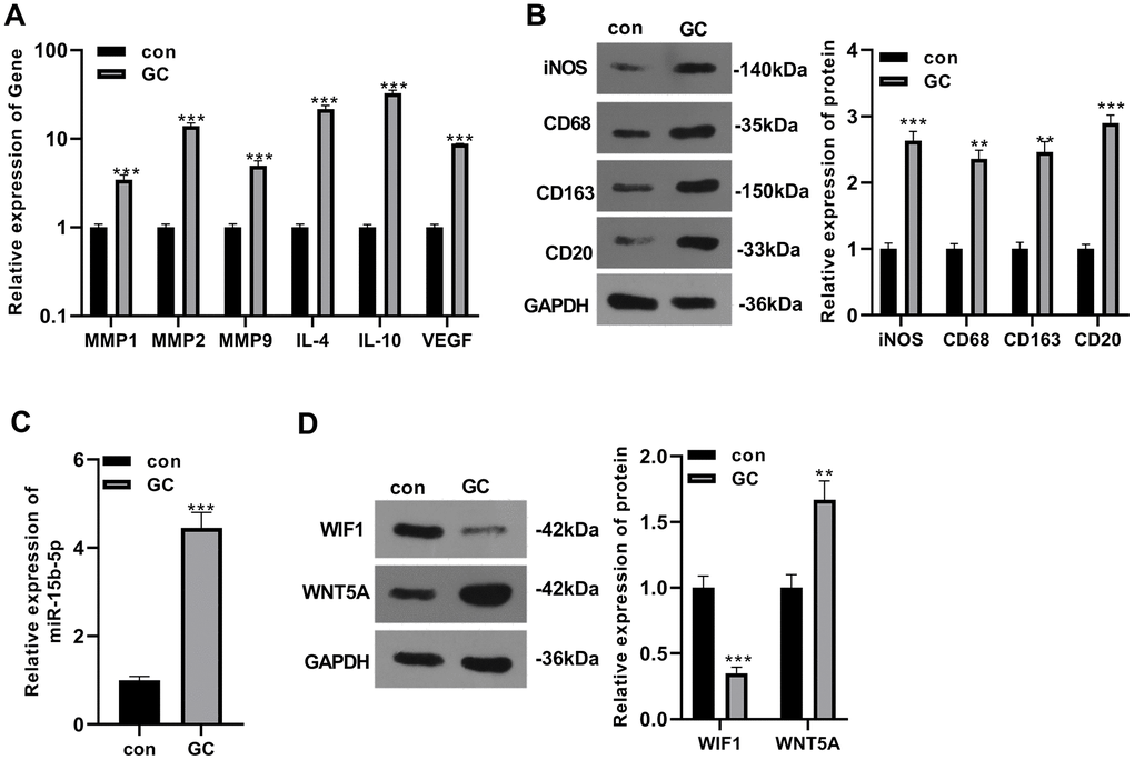 Gastric cancer cells promoted the formation of tumor-associated macrophages and enhanced the miR-15b-5p expression in tumor-associated macrophages. THP-1 monocytes were co-cultured with GC cells for 24 hours to obtain TAMs. (A) QRT-PCR was adopted to calculate the expression of molecular markers (MMP1, MMP2, MMP9, IL-4, IL-10, and VEGF) of TAMs. (B) WB was implemented to verify the expression of molecular markers (iNOS, CD68, CD163 and CD20) of TAMs. (C) The miR-15b-5p level was monitored by qRT-PCR. (D) The WIF1/WNT5A expression was examined by WB. *PPP