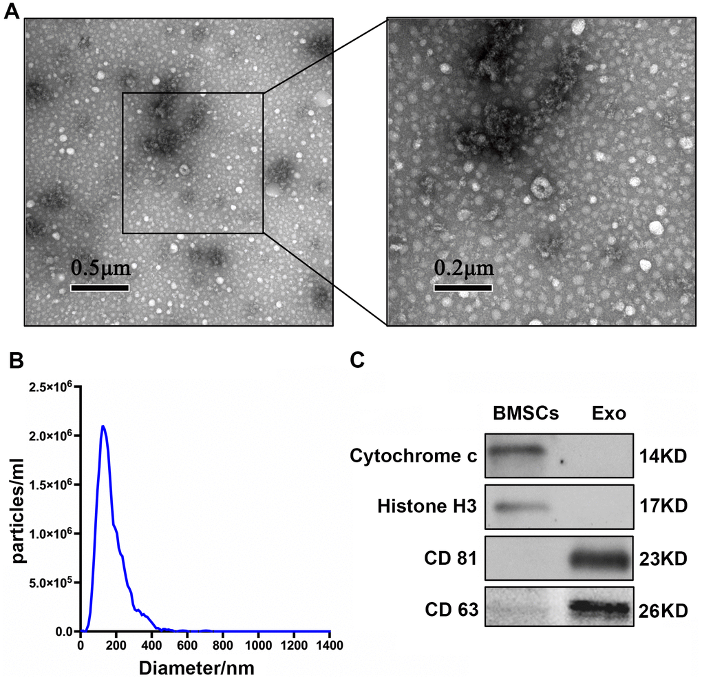 Characterization of BMSC-Exos. (A) TEM analysis of BMSC-Exos is shown. (B) NTA showed that the main peak of the particle size was 132.4 nm. (C) CD81, CD63, cytochrome C, and histone H3 were detected by western blot.
