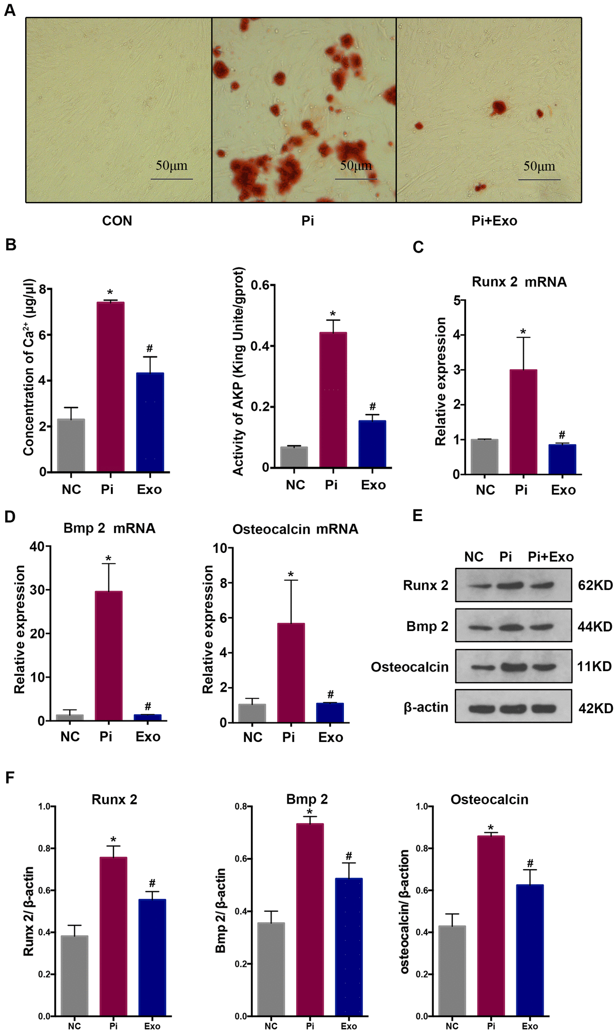 (A) Alizarin Red S staining showed mineral deposits in HA-VSMCs under different treatments. (B) Determination of the Ca2+ concentration and AKP activity in each group. (C, D) RT-qPCR analysis of mRNAs associated with osteogenic transdifferentiation. (E, F) Western blot analysis of protein expression. *P#P