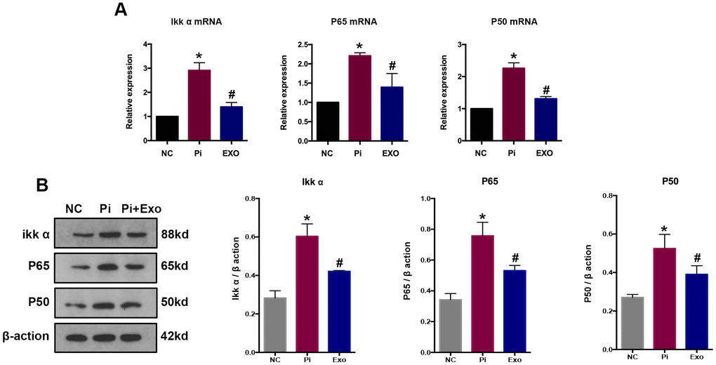 (A) RT-qPCR analysis of mRNAs in the NF-κB signaling pathway. (B) Western blot analysis of proteins in the NF-κB signaling pathways *P#P