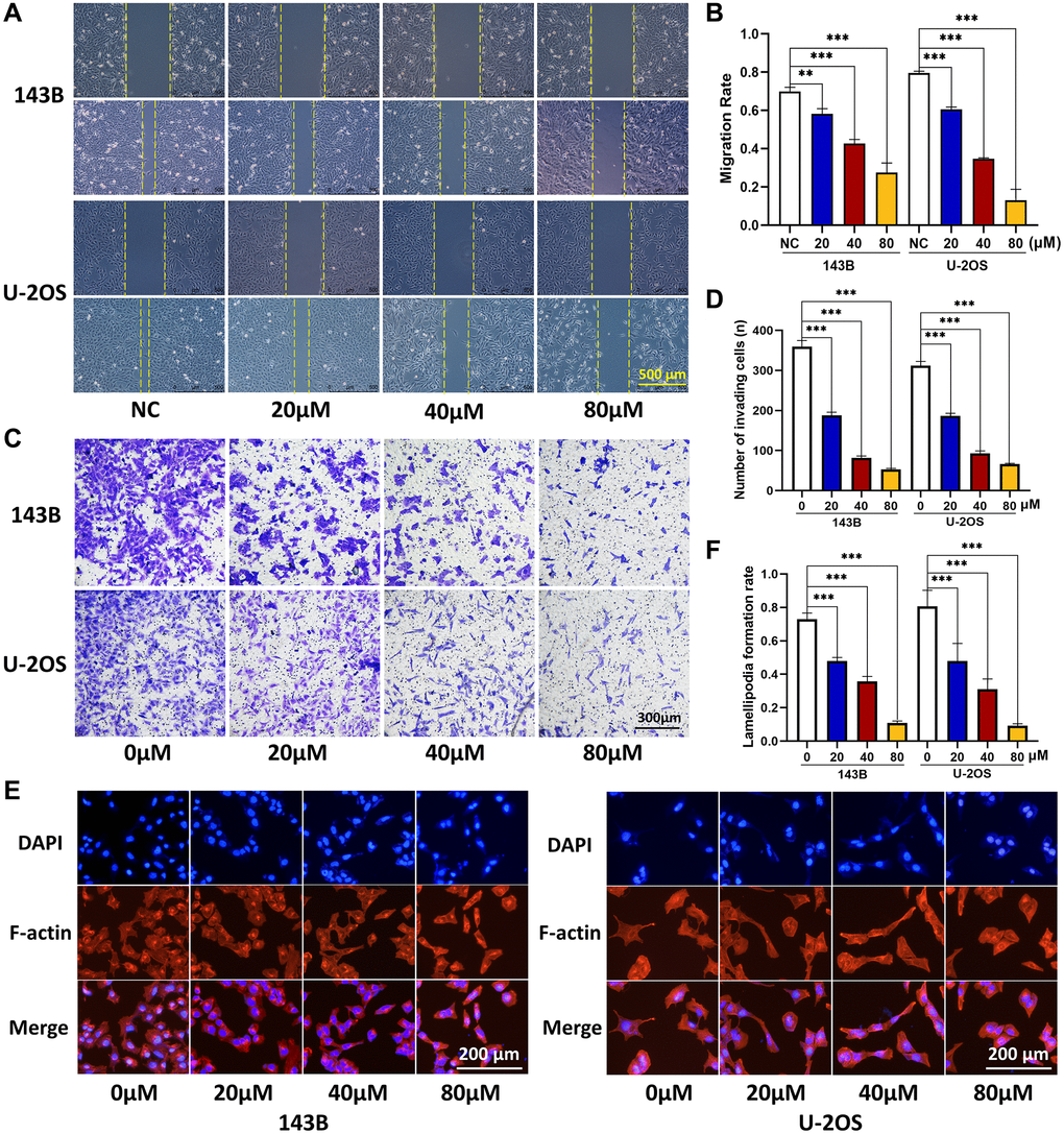 CQ suppress the OS cell migration, invasion, and lamellipodia formation. (A, B) Migration ability of OS cells was inhibited gradually by CQ with the increasing of concentration (**P ***p n = 3). (C, D) Invasion ability of OS cells was inhibited gradually by CQ with the increasing of concentration (***p n = 3). (E, F) Cytoskeletal assay showed that the lamellipodia formation of OS cells was inhibited gradually by CQ with the increasing of concentration (***p n = 3). The data were expressed as the mean ± SEM.