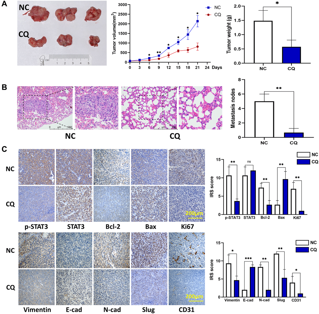 CQ suppression of mouse OS cell xenograft growth and lung metastasis in vivo. (A) Xenograft photographs, growth curves of tumor, and tumor weight showed that CQ suppressed xenograft growth in nude mice (*p n = 3). (B) HE staining of mouse lung tissues. The results showed suppression of lung metastasis in vivo (**p n = 3). (C) Representative pictures from IHC assay. p-STAT3, STAT3, Bcl-2, Bax, Ki67, Vimentin, E-cadherin, N-cadherin, Slug, and CD31 expression in the tumors collected from different groups were determined using IHC (ns p > 0.05; *p **p ***p n = 3). The data were expressed as the mean ± SD.