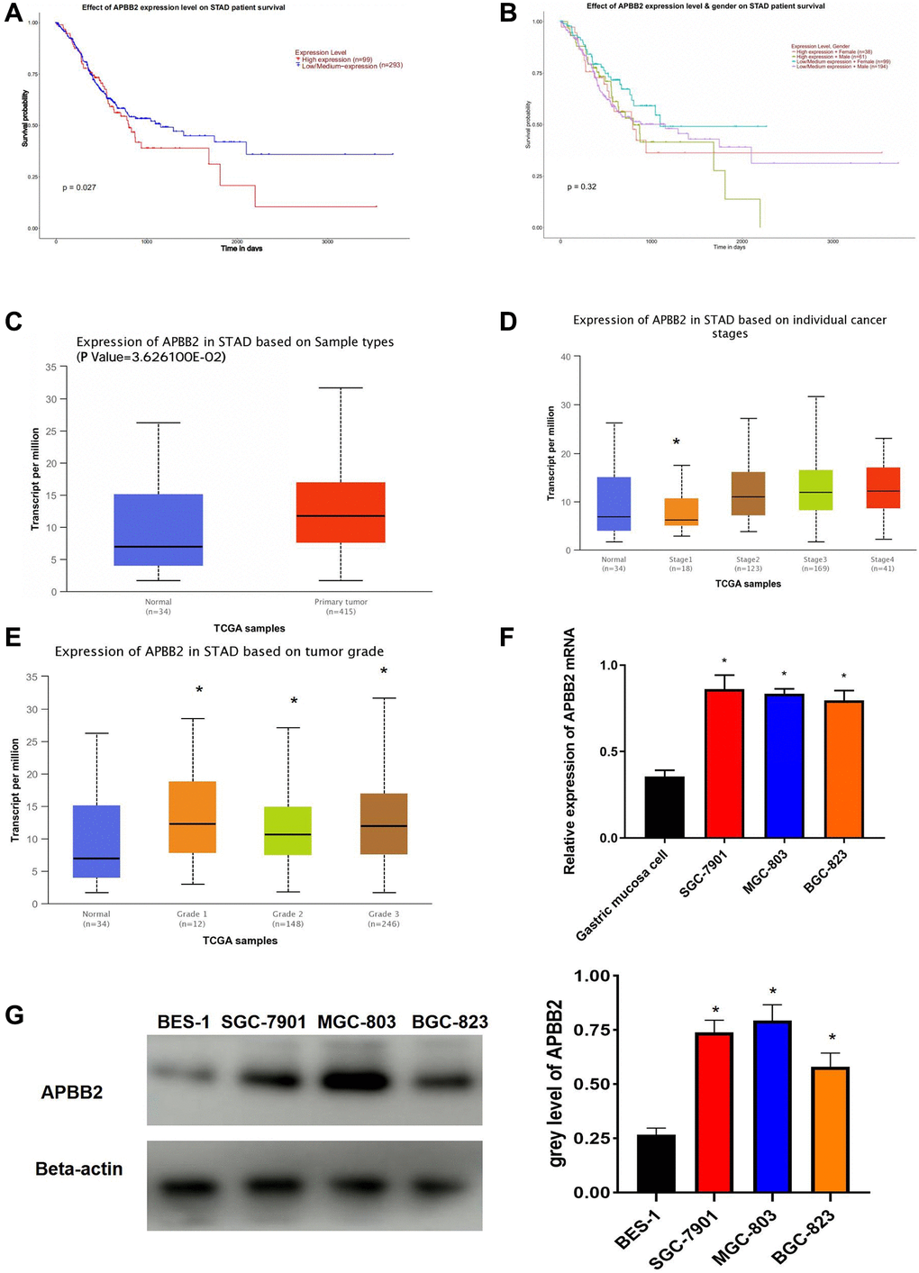 APBB2 expression and associated prognosis in GA. (A) Survival curves of APBB2 expression to evaluate patient prognosis in the TCGA-GA dataset. Red represents the high expression group and blue indicates low expression. (B) Survival curves of APBB2 expression to evaluate male and female patient prognosis in the TCGA-GA dataset. (C) Compared with the normal group (blue), high levels of APBB2 expression was observed in the tumor samples (red). (D and E) Box plots of APBB2 expression at different clinical stages, N stages of GA. (F and G) The level of APBB2 mRNA and protein expression in BES-1 and GA cell lines (SGC-7901, MGC-803, and BGC-823). *P 