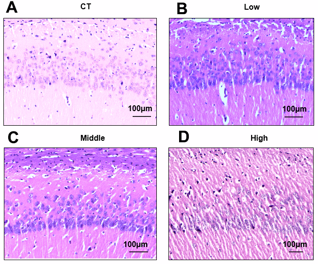 Effects of STX exposure on the pyramidal cells and neuronal cells in the CA1 area of the hippocampus. (A–D) Representative photomicrographs of Hematoxylin-Eosin (HE) staining of brain sections (n = 6 for each group) from CT, Low, Middle and High group. Magnification, 100×. Scale bar, 100 μm.