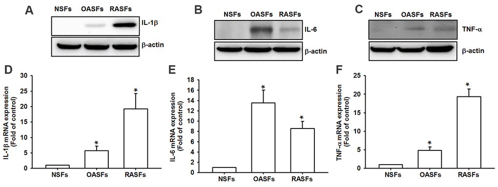 Higher levels of proinflammatory cytokines in OA and RA synovial fibroblasts. Levels of IL-1β, IL-6 and TNF-α protein (A–C) and mRNA expression (D–F) in NSFs, OASFs and RASFs were examined by Western blot and qPCR assays.