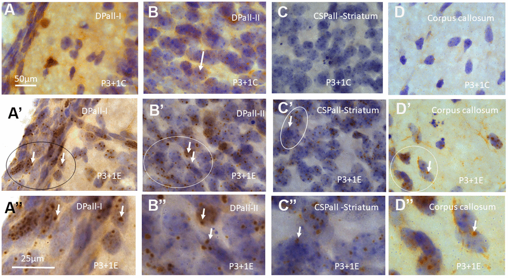 γH2AX immunostaining counterstained with hematoxylin shows very few γH2AX foci in different brain regions of postnatal day 4 (P4) mice without irradiation including dorsal pallium(DPall) /isocortex layer I (DPall-I) and pia mater (A), DPall –II (B, arrow), central subpallium/classic basal ganglia (CSPall) striatum (C) and corpus callosum (D). However, acute irradiation with 5Gy at P3 induced very significant γH2AX expression in the entire brain 1 day after radiation exposure or P4 mice. γH2AX foci could be observed in almost all brain regions at 1 day after irradiation at P3, including DPall-I (A’, A” is magnified from the ellipse in A’), DPall-II to DPall-VI of the grey mater (B’, B”, DPall-II, B” is magnified from the ellipse in B’), CSPall striatum (C’, C” is magnified from the ellipse in C’) and corpus callosum (D’, D” is magnified from the ellipse in D’) at 1 day after irradiation at P3. Scan bar=50μm in (A) applies to (B–D) (A’–D’) Scan bar=25μm in (A”) applies to (B” –D”).