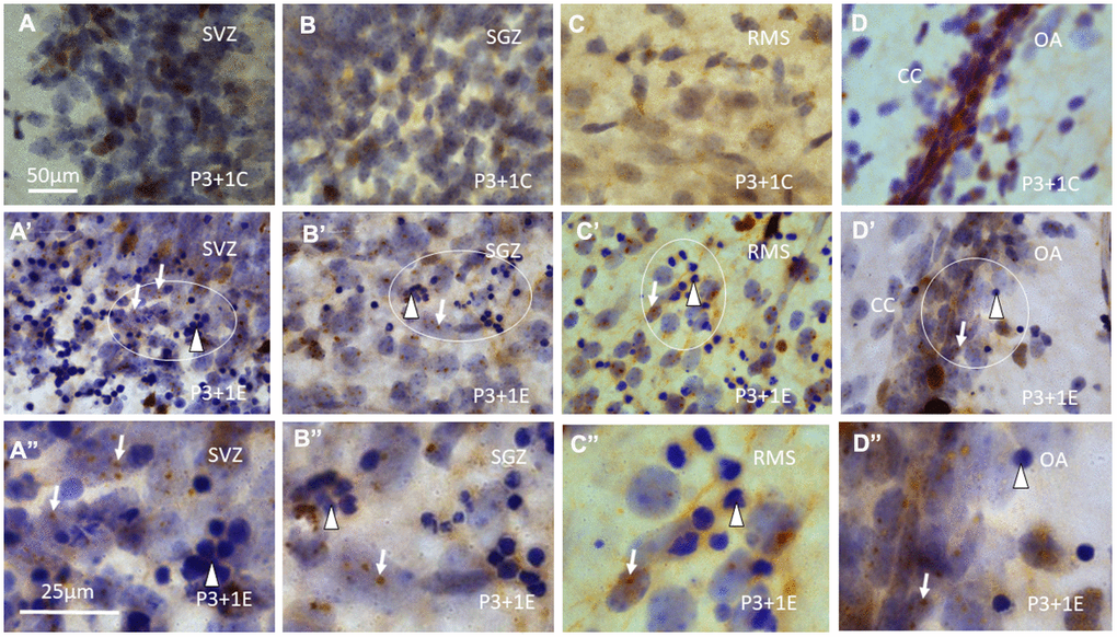 γH2AX immunostaining counterstained with hematoxylin shows that γH2AX foci are almost undetectable in the subventricular zone (SVZ) (A) of the lateral ventricle, subgranular zone (SGZ) (B), rostral migratory stream (RMS) (C) and the border between dorsal hippocampus (O/A: border between stratum oriens and alveus) and corpus callosum (CC) (D) of P4 mice without irradiation. Irradiation with 5Gy induced obvious γH2AX foci (arrows) in SVZ (A’, A” is magnified from the ellipse in A’), SGZ (B’, B” is magnified from the ellipse in B’), RMS (C’, C” is magnified from the ellipse in C’) and the border between O/A and CC (D’, D” is magnified from the ellipse in D’). Furthermore, many apoptotic bodies (arrowheads) appear in SVZ (A’, A”), SGZ (B’, B”), RMS (C’, C”) and the border between O/A and CC (D’, D”) at 1 day after irradiation at P3. Scan bar=50μm in (A) applies to (B–D) (A’–D’) Scan bar=25μm in (A”) applies to (B”–D”).