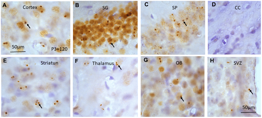 γH2AX immunostaining counterstained with hematoxylin shows irradiation-induced γH2AX foci (arrows) in different brain regions including cortex (A), stratum granulosum of the dentate gyrus (B), stratum pyramidale of CA1 area of the hippocampus (C), corpus callosum (CC) (D), striatum (E), thalamus (F), olfactory bulb (G) and subventricular zone of the lateral ventricle (H) at 120 days after irradiation at P3. Scan bar=50μm in (A) applies to (B–H).