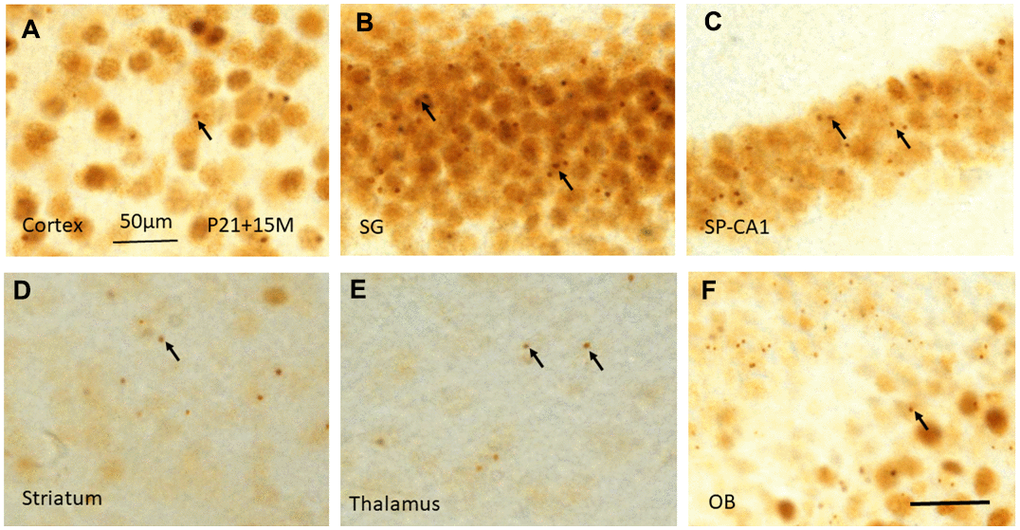 γH2AX immunostaining shows irradiation-induced γH2AX foci (arrows) in different brain regions including cortex (A), stratum granulosum of the dentate gyrus (B), stratum pyramidale of CA1 area of the hippocampus (C), striatum (D), thalamus (E), and olfactory bulb (F) at 15 months after irradiation at P21. Scan bar=50μm in (A) applies to (B–F).