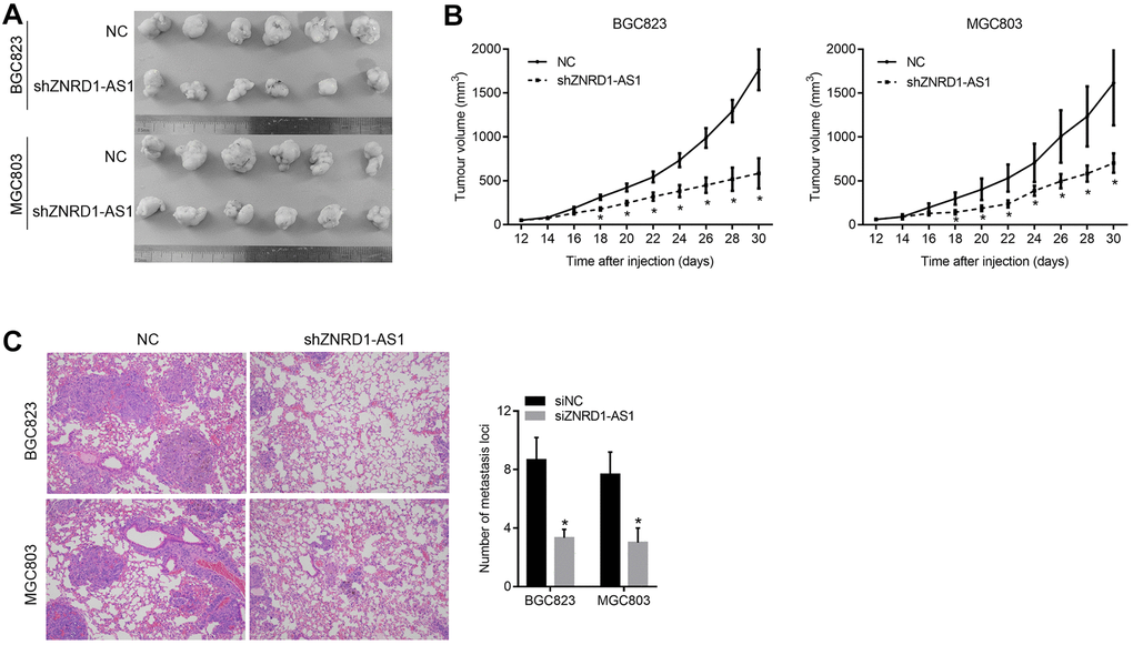 ZNRD1-AS1 knockdown suppresses tumor growth and pulmonary metastasis in a nude mouse model. (A) Micrographs of subcutaneous tumors formed by MGC803 and BGC823 cells of the shZNRD1-AS1 and NC groups. (B) Growth curves of subcutaneous tumors formed by MGC803 and BGC823 cells of the shZNRD1-AS1 or NC groups. (C) Metastasis in the lungs of nude mice intravenously injected with MGC803 and BGC823 cells from the shZNRD1-AS1 or NC groups. Left panels show representative micrographs. The right panel is a graph of mean metastatic loci.