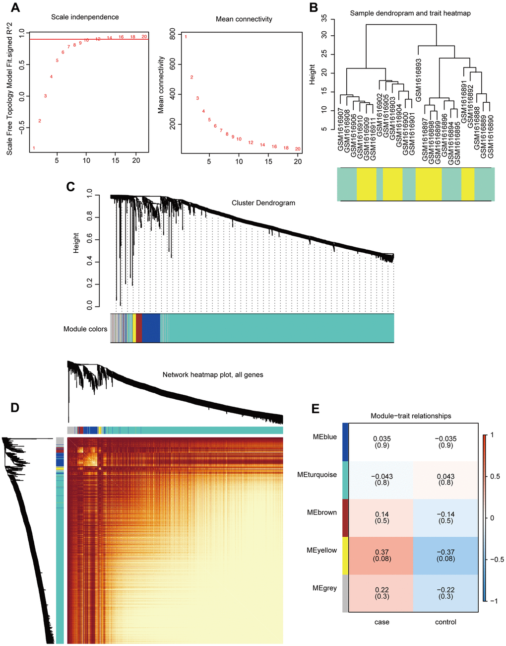 Construction and analysis of co-expression modules. (A) Optimal threshold selection map for breast cancer bone metastasis co-expression. (B) Clustering of breast cancer bone metastasis samples. (C) Phylogenetic tree of module clustering. (D) Co-expression analysis heat map. (E) Breast cancer bone metastasis modules and traits.