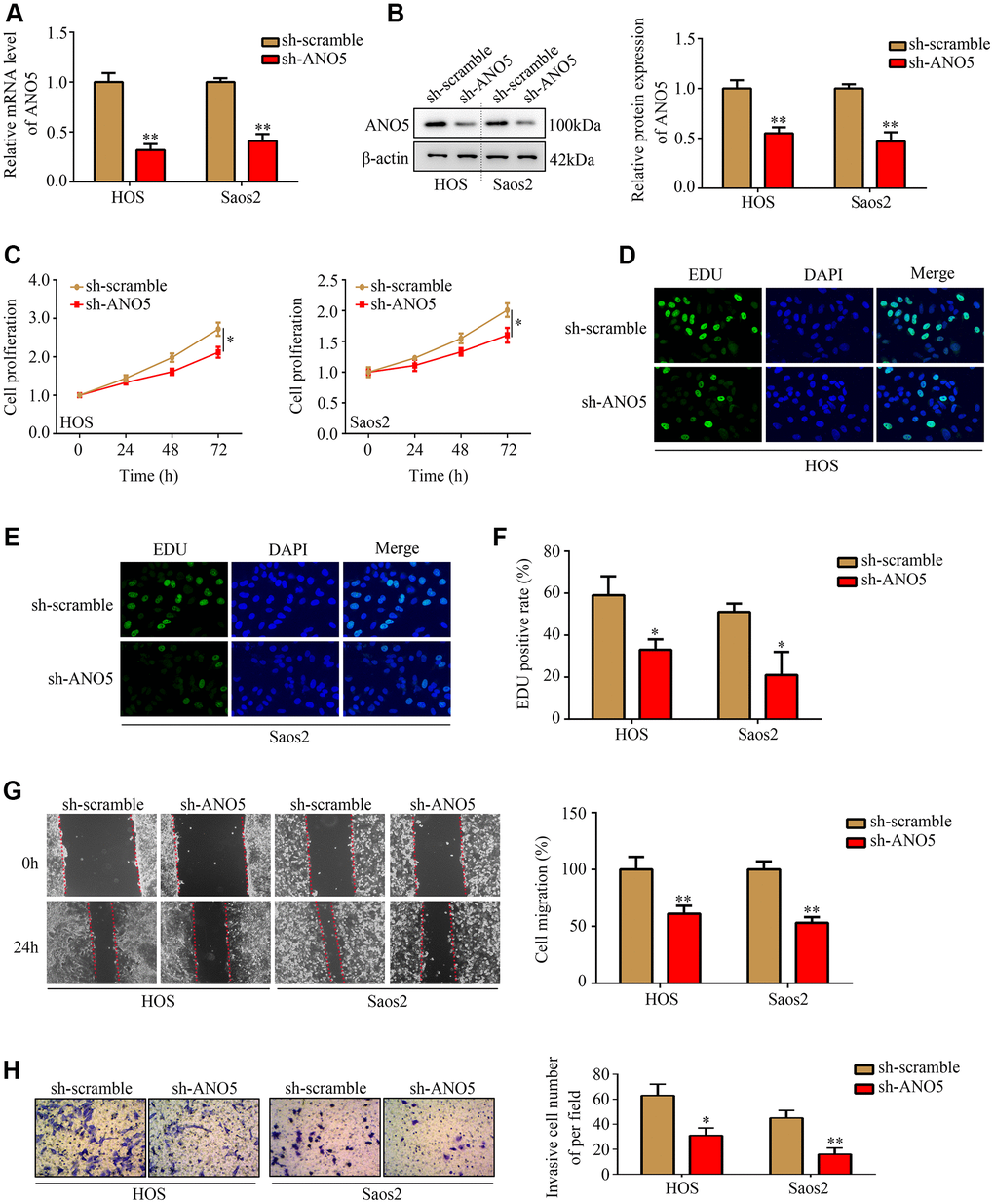 Inhibition of ANO5 decreased osteosarcoma cell proliferation and metastasis in vitro. (A, B) qRT-PCR and western blot were used to determine the transfection efficiency of targeted ANO5 shRNA. (C) A CCK-8 assay was used to evaluate the effects of ANO5 knockdown on osteosarcoma cell proliferation. (D–F) EDU assays showed that proliferation rates were reduced in ANO5 knockdown osteosarcoma cells. (G) A wound healing assay was used to examine the effect of ANO5 inhibition on osteosarcoma cell migration. (H) A transwell assay was used to determine the effect of ANO5 knockdown on osteosarcoma cell invasion. *, PP