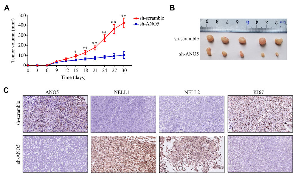 Inhibition of ANO5 decreased cell proliferation and NELL1 and NELL2 expression in vivo. (A, B) ANO5 knockdown decreased HOS cell proliferation in vivo. (C) IHC showed that inhibition of ANO5 decreased the expression of KI67 and increased the expression of NELL1 and NELL2. *, PP