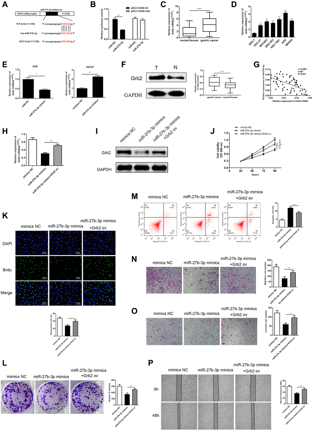 MiR-27b-3p binds and negatively modulates Grb2, and Grb2 can reverse inhibition of GC cell promotion brought by miR-27b-3p. (A) The complementary sequence between miR-27b-3p and Grb2 3’UTR. (B) Luciferase reporter assay verifies a direct relationship between miR-27b-3p and Grb2 (P = 0.0041). (C) Across 60 GC tissue samples, Grb2 levels were higher compared to adjacent cancer (P D) Grb2 levels in GC cell lines is higher than that in gastric mucosa epithelial cells. AGS had the highest expression, while HGC-27 was relatively low. (E) Grb2 mRNA expression was lower in the miR-27b-3p mimics group (P = 0.0376) and was higher in the miR-27b-3p inhibitor group (P = 0.0034). (F) Grb2 expression in GC and adjacent tissues was detected through western blot (P G) There is a negative correlation between Grb2 and miR-27b-3p expression. (H–I) Up-regulation of Grb2 mRNA and protein levels were determined using qRT-PCR and WB after Grb2 ov in the miR-27b-3p mimics group (P = 0.0019). (J–K) CCK-8 and BrdU assays (P = 0.0128) detected GC cell viability and proliferation ability, respectively. Up-regulated Grb2 mRNA levels were positively associated with GC cell growth. (L) Colony formation assay detected the numbers of colony formation (P = 0.0075). (M) GC cell apoptosis was inhibited upon overexpression of Grb2, as examined by flow cytometry assay (P = 0.0009). (N–O) Accelerated cell migration (P = 0.0089) and invasion (P = 0.0125) abilities were found by transwell assays brought on by increased Grb2 levels. (P) Wound healing assay was utilized to discover GC cell metastasis, which indicated that high Grb2 levels promote GC cell metastasis (P = 0.0017).