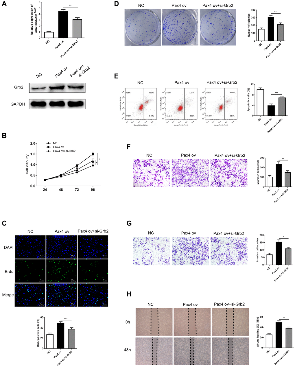 Grb2 knockdown can attenuate PAX4 ov-induced effect on GC cell progression. (A) Lower Grb2 levels were determined via qRT-PCR and western blot after adding si-Grb2 to the PAX4 ov group (P = 0.0025). (B–C) Grb2 knockdown weakened GC cell proliferation induced by PAX4 ov, through CCK-8 and BrdU assays (P = 0.0009). (D) Grb2 knockdown decreased PAX4-ov-induced numbers of colony formation, via the colony formation assay (P = 0.0013). (E) GC cell apoptosis was elevated upon addition of si-Grb2 to the PAX4 ov group (P = 0.0004). (F–G) Reduced cell migration (P = 0.0059) and invasion (P = 0.0121) was identified after adding si-Grb2 to PAX4 ov group by transwell assays. (H) Grb2 knockdown declined migration induced by PAX4 ov by wound healing assay (P = 0.0060).