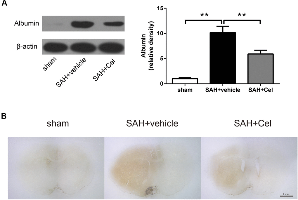 Celastrol decreased albumin leakage after SAH. (A) Protein levels of albumin in the ipsilateral basal cortex in sham, SAH + vehicle, and SAH + Cel groups at 72 h after SAH induction, detected by WB. (B) Representative histological slides of the albumin staining in the perivascular regions of the ipsilateral basal cortex in sham, SAH + vehicle, and SAH + Cel group. Data were presented as mean±SEM. n = 6. **P 