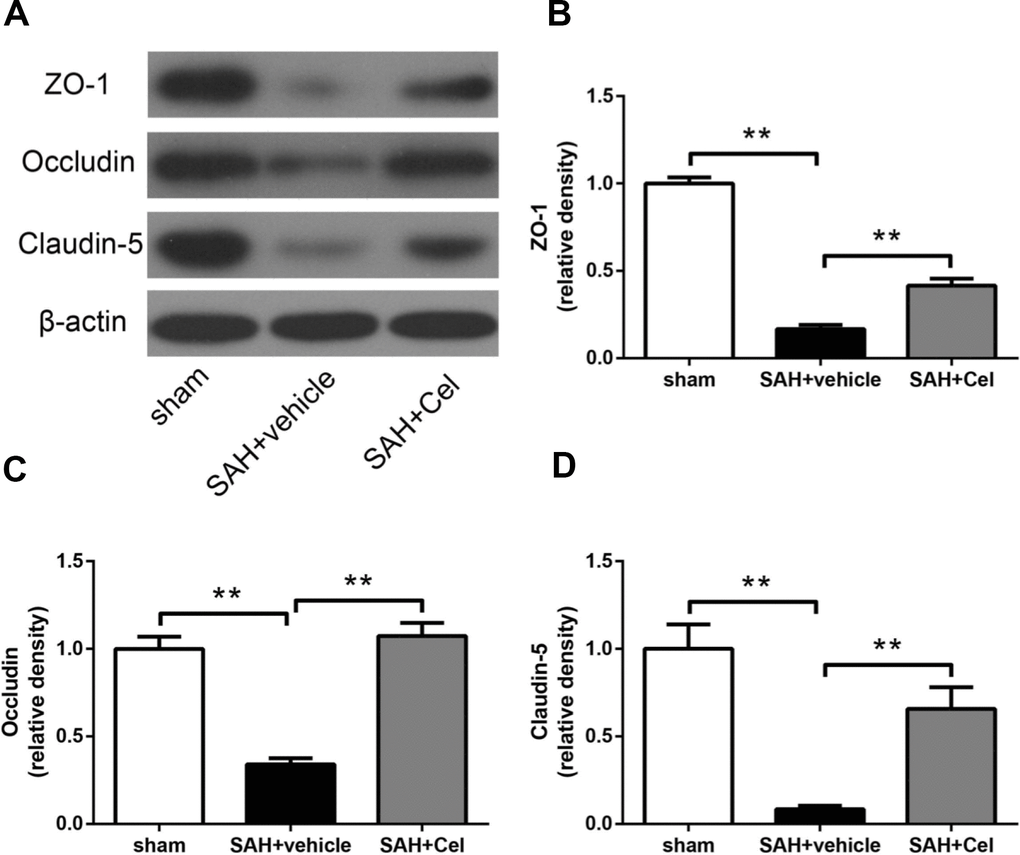 Effects of celastrol treatment on tight junction proteins at 72 h after SAH induction. (A) Representative western blots showing levels of ZO-1, occludin and claudin-5 in the ipsilateral cortex at 72 h after SAH induction. (B–D) Quantification of band densities of ZO-1, occludin and claudin-5. The densities of the protein bands were analyzed and normalized to β-actin, and compared to the mean value of the sham group. Data were presented as mean±SEM. n = 6. **P 